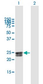 FLJ20397 Antibody in Western Blot (WB)