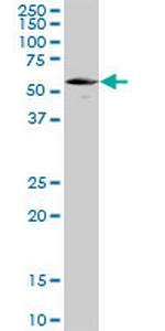 UCKL1 Antibody in Western Blot (WB)