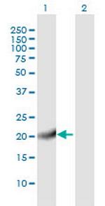 C20orf27 Antibody in Western Blot (WB)