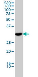 FLJ20643 Antibody in Western Blot (WB)