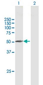 PPP2R3C Antibody in Western Blot (WB)