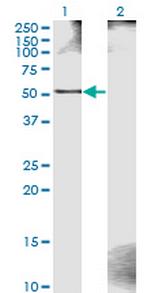 ZWILCH Antibody in Western Blot (WB)