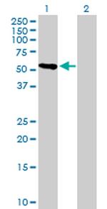 CRTAC1 Antibody in Western Blot (WB)