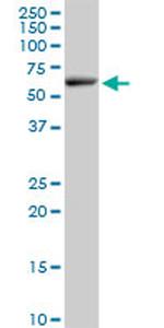 ELP3 Antibody in Western Blot (WB)