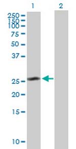 CEP27 Antibody in Western Blot (WB)