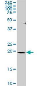 THAP1 Antibody in Western Blot (WB)