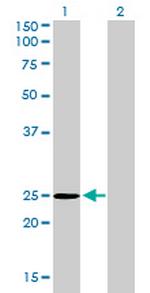 THAP1 Antibody in Western Blot (WB)