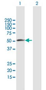 RBM23 Antibody in Western Blot (WB)