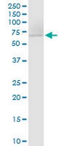 DARS2 Antibody in Western Blot (WB)