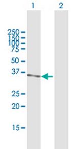 PRMT6 Antibody in Western Blot (WB)