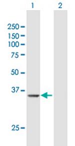 PRMT6 Antibody in Western Blot (WB)