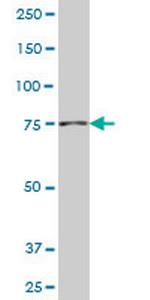 NADSYN1 Antibody in Western Blot (WB)