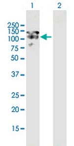 MAP1S Antibody in Western Blot (WB)