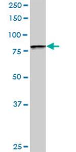 BBS7 Antibody in Western Blot (WB)