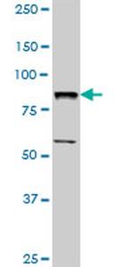 BBS7 Antibody in Western Blot (WB)