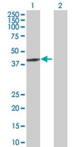 UBA6 Antibody in Western Blot (WB)