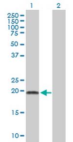 ADI1 Antibody in Western Blot (WB)