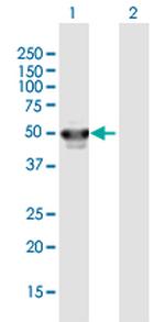 PHF10 Antibody in Western Blot (WB)