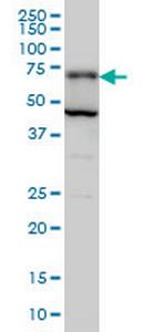 PGM2 Antibody in Western Blot (WB)