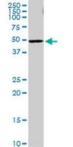 PI4KII Antibody in Western Blot (WB)