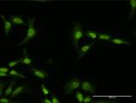 PI4K2A Antibody in Immunocytochemistry (ICC/IF)