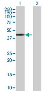 ZNF331 Antibody in Western Blot (WB)