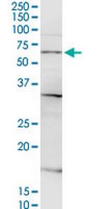 CSGALNACT2 Antibody in Western Blot (WB)