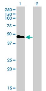 TNFRSF19 Antibody in Western Blot (WB)