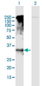 GPRC5D Antibody in Western Blot (WB)