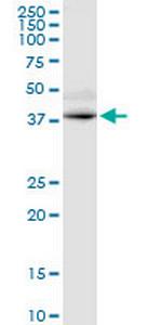 GPRC5D Antibody in Western Blot (WB)