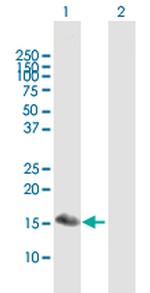 SNFT Antibody in Western Blot (WB)