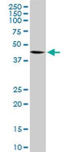 ELAC1 Antibody in Western Blot (WB)