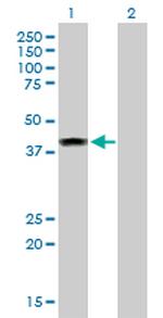 ELAC1 Antibody in Western Blot (WB)