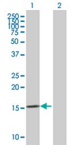 KLK15 Antibody in Western Blot (WB)