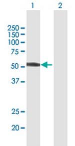 ZNF821 Antibody in Western Blot (WB)