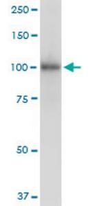 ZCCHC8 Antibody in Western Blot (WB)