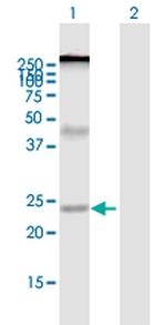 ZDHHC7 Antibody in Western Blot (WB)