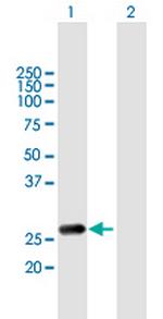 RAB20 Antibody in Western Blot (WB)