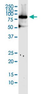 MFN1 Antibody in Western Blot (WB)