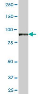 VAC14 Antibody in Western Blot (WB)