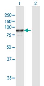 VAC14 Antibody in Western Blot (WB)