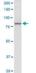 VPS35 Antibody in Western Blot (WB)