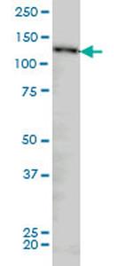 NUP133 Antibody in Western Blot (WB)