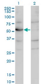 CNDP2 Antibody in Western Blot (WB)