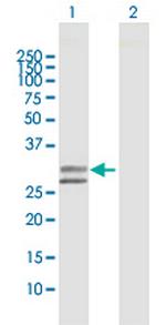 UGCGL2 Antibody in Western Blot (WB)