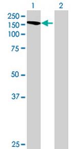 TTC17 Antibody in Western Blot (WB)