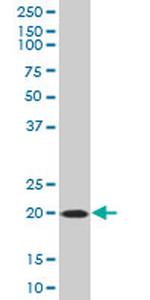 SELS Antibody in Western Blot (WB)