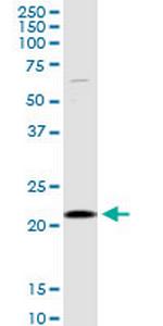 SELS Antibody in Western Blot (WB)