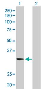 CENPJ Antibody in Western Blot (WB)