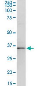 USE1 Antibody in Western Blot (WB)